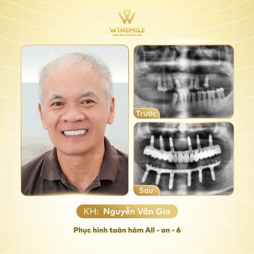 Slider image (5) WinSmile Dental Clinic Vietnam